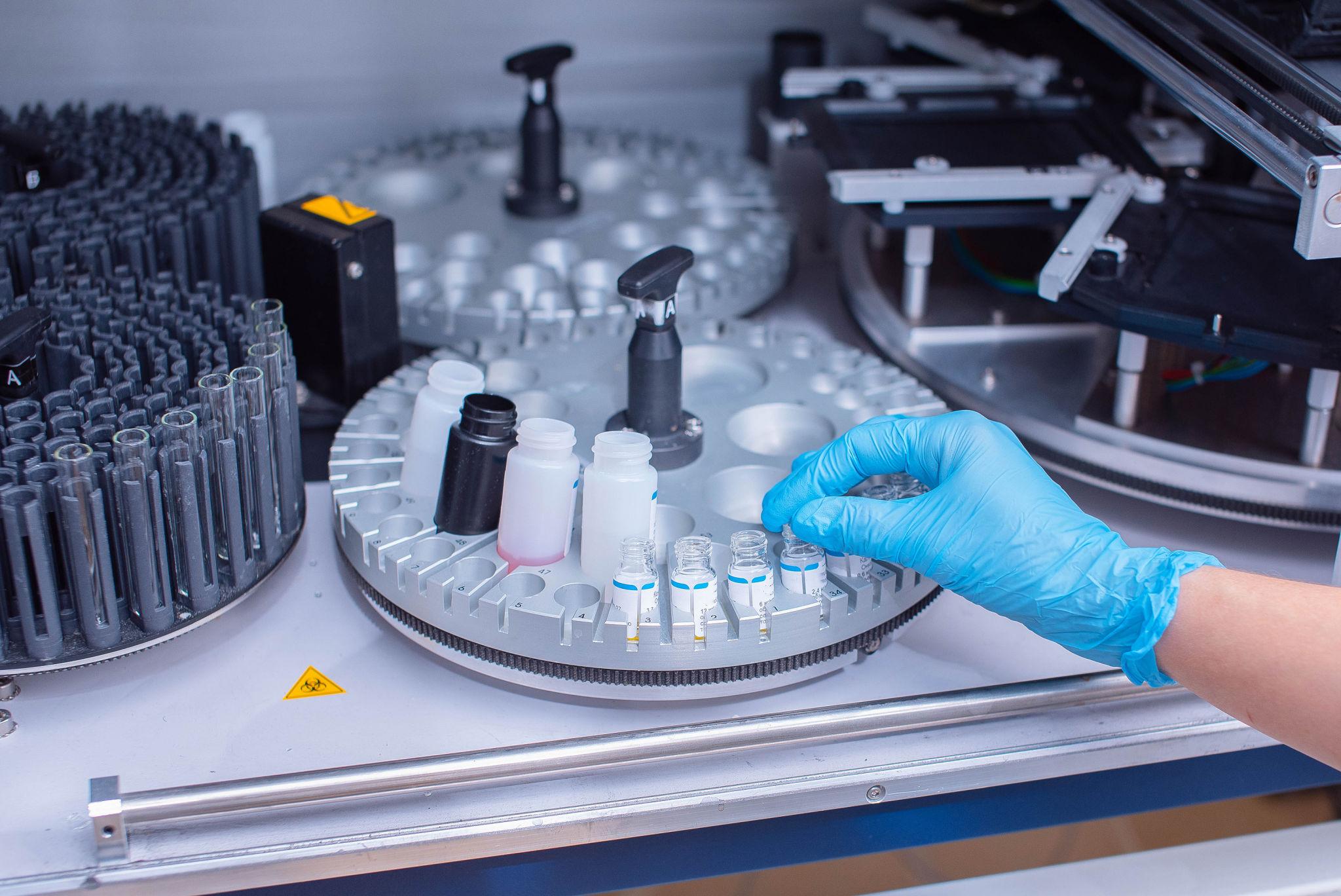 Fermentga bog'liq immunosorbent tahlili (ELISA)